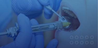 Extraction (complex)